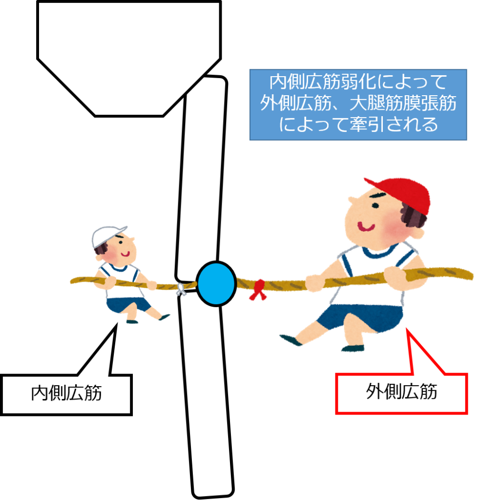Q角(Q-angle)の正常値、測定方法とは?FTAとの違いも解説! - 白衣のドカタ