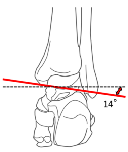 距腿関節冠状面運動軸